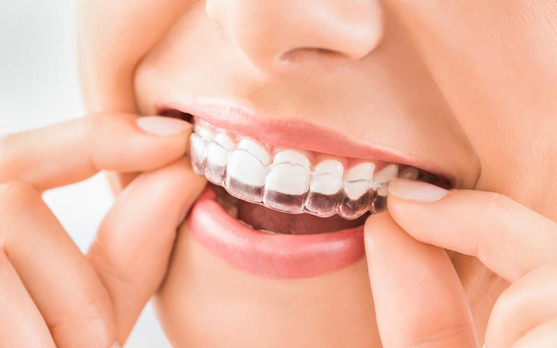 Dentist Bendigo, invisalign, orthodontics, dental services