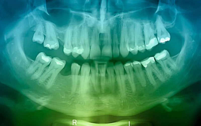 dental services, dental x-rays, general dentistry